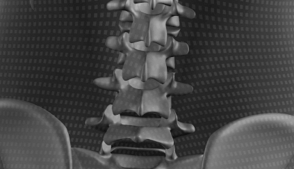 low back pain scans and diagnosis newcastle physiotherapy
